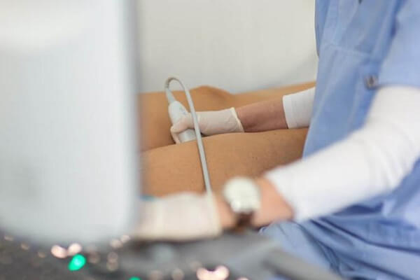 United Medical | Doppler krvnih sudova nogu
