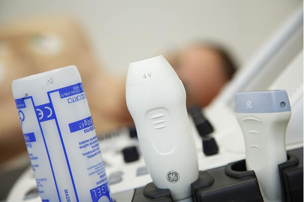 United Medical | Doppler renalnih arterija