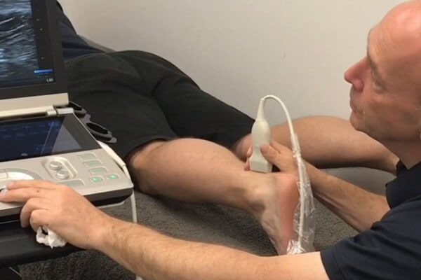 United Medical | Ultrazvučni pregled Ahilove tetive